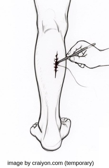 needle_thread.jpg